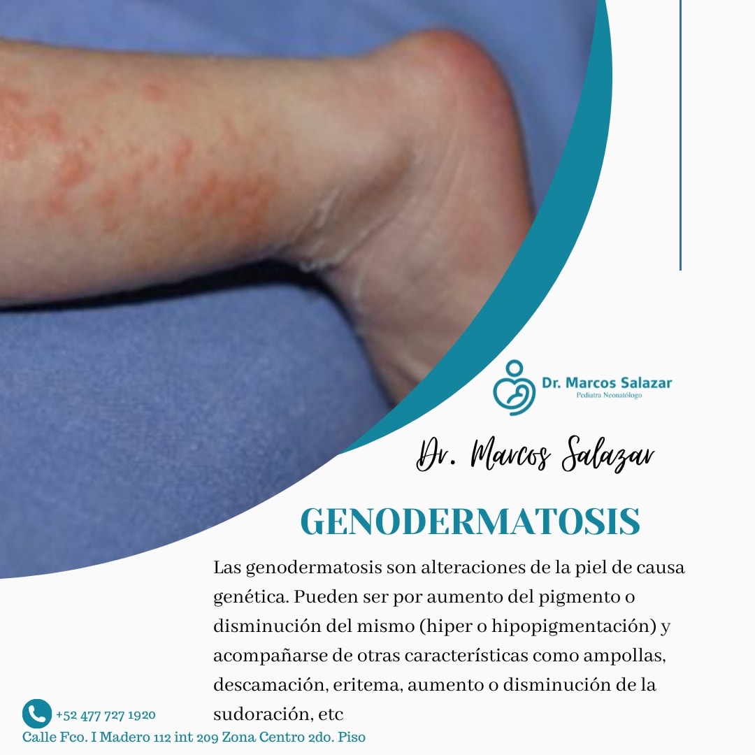 ️Las genodermatosis son... - Dr Marcos Salazar Torres