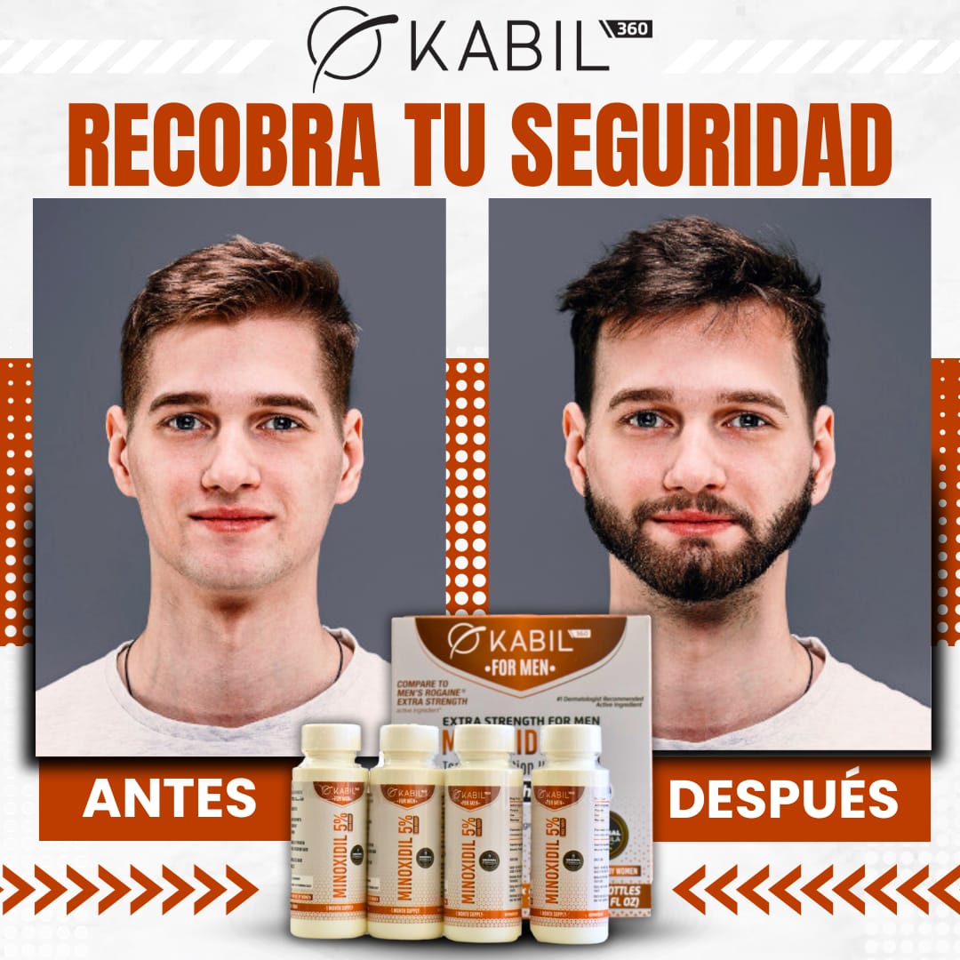 KABIL 360 - 🌟 ¡Recobra tu seguridad con Kabil Minoxidil! 🌟... | Facebook