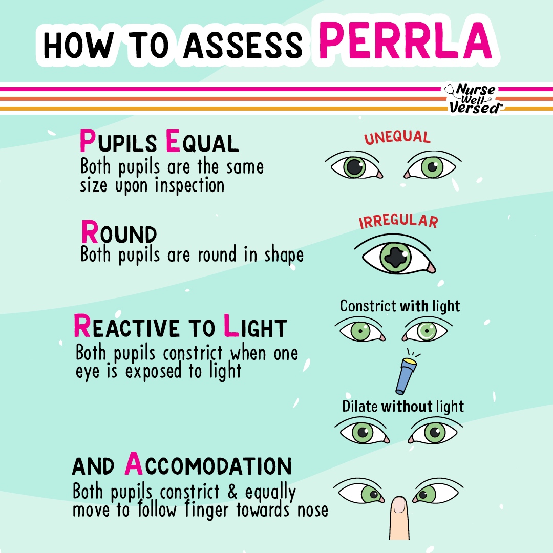 👁️ PERRLA Explained Follow... - Nurse Well Versed | Facebook