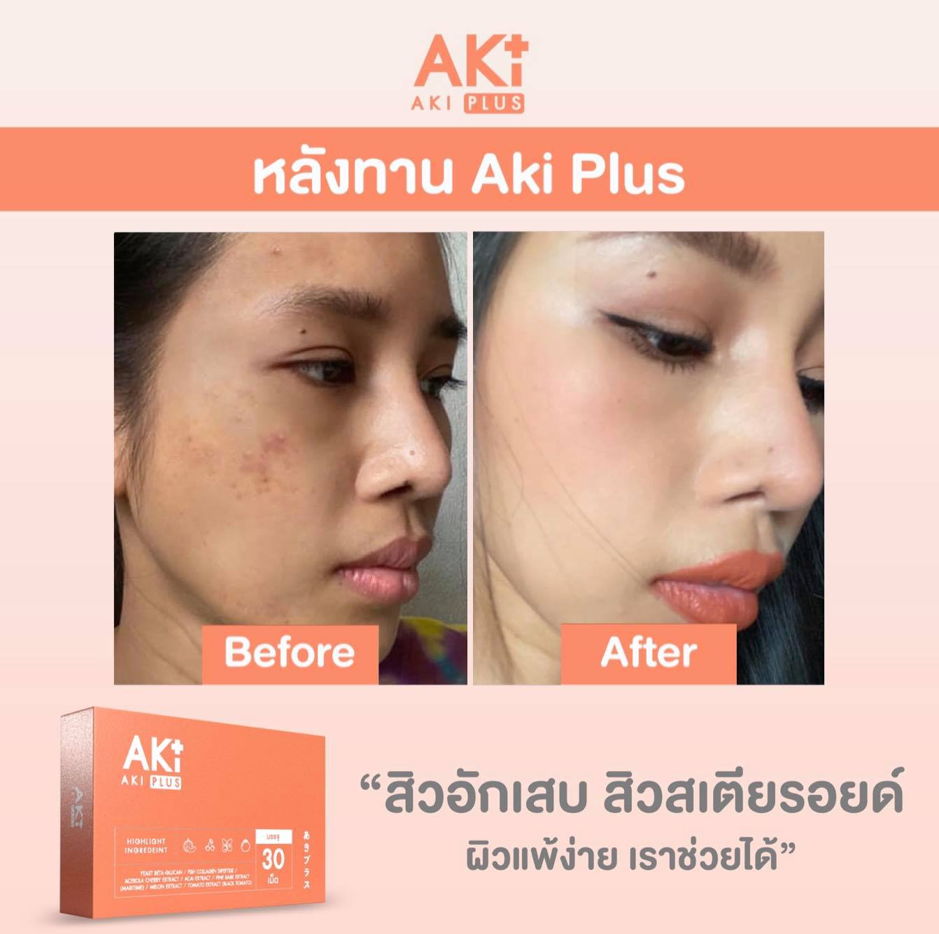 ขอบคุณรีวิวจากคุณเบล TIKTOKER... - AKI PLUS - เพจหลักบริษัท | Facebook
