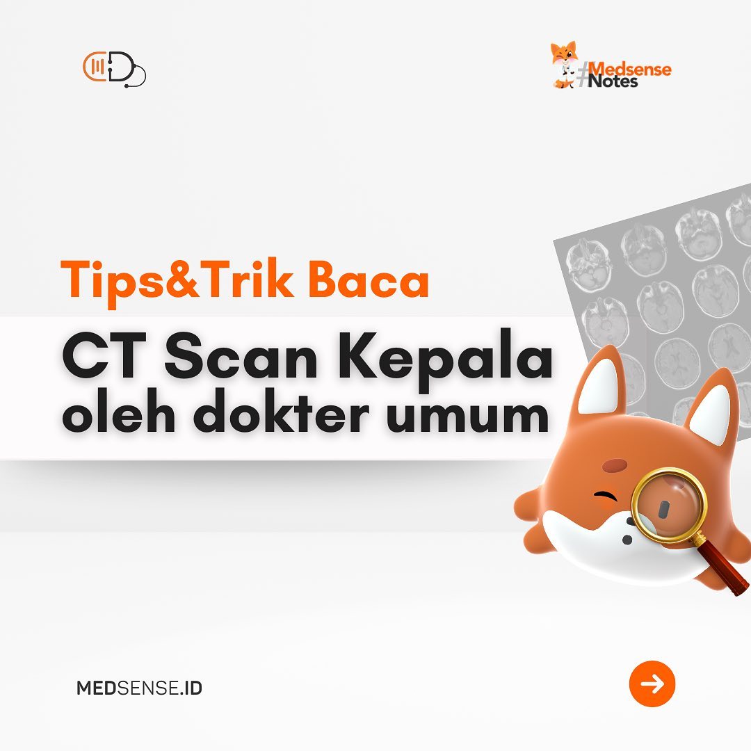 Baca CT-Scan Kepala dengan ABC yuk!... - Medsense Indonesia | Facebook