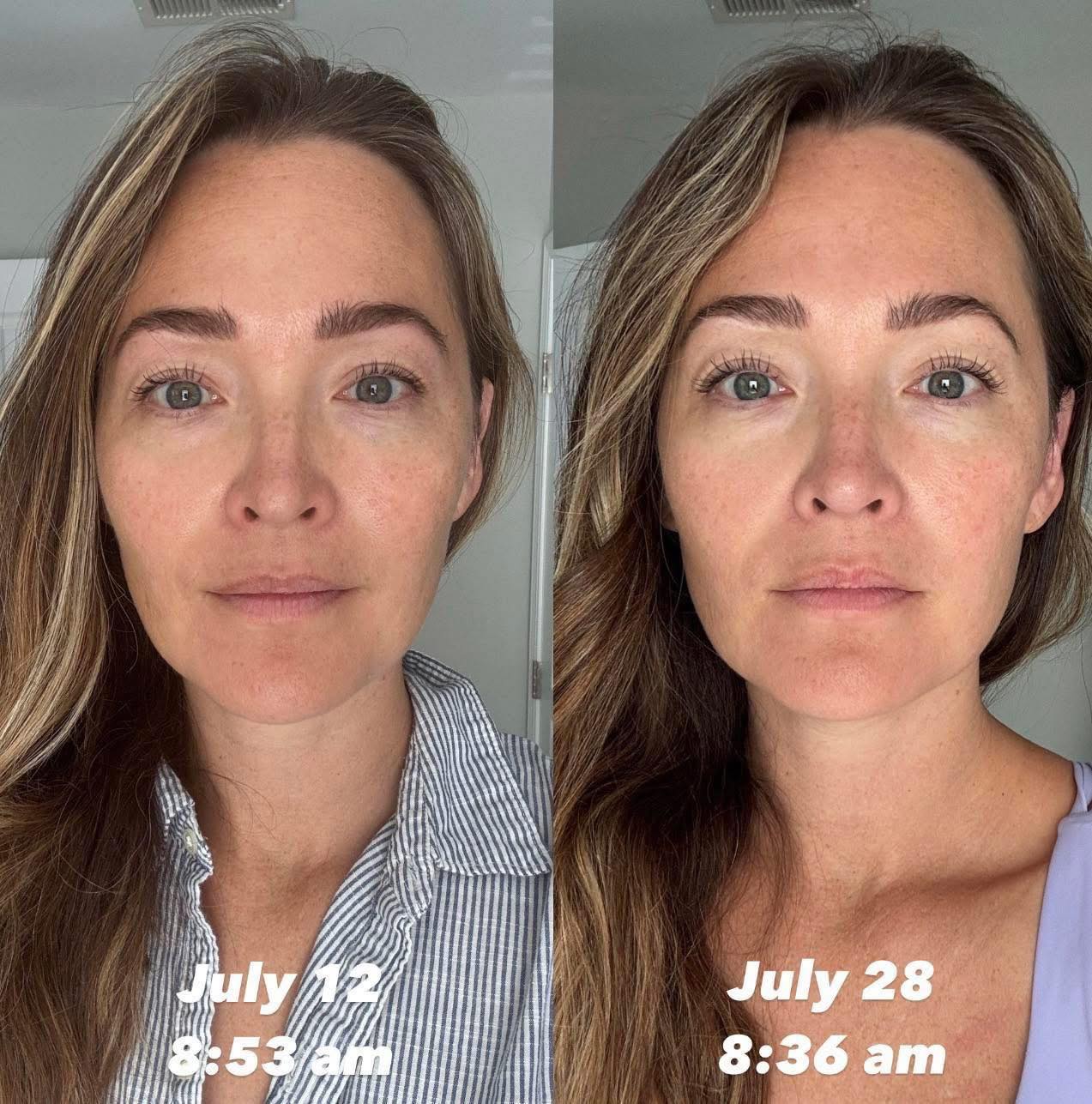 does ghk cu make your skin glow 12 weeks in, and my has NEVER looked better! peptides are doing their thing. Alright, I need to give you an update—it's been 12 weeks since I started using GHK Designed for all skin The FDA Is About Gastrointestinal Support Amount:15mg