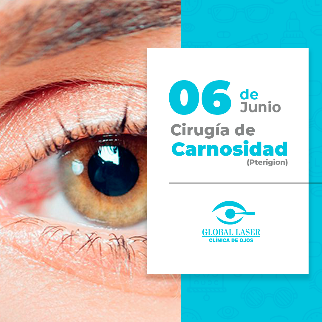 ATENCIÓN HUÁNUCO !!!... - Clínica de Ojos Global Laser | Facebook