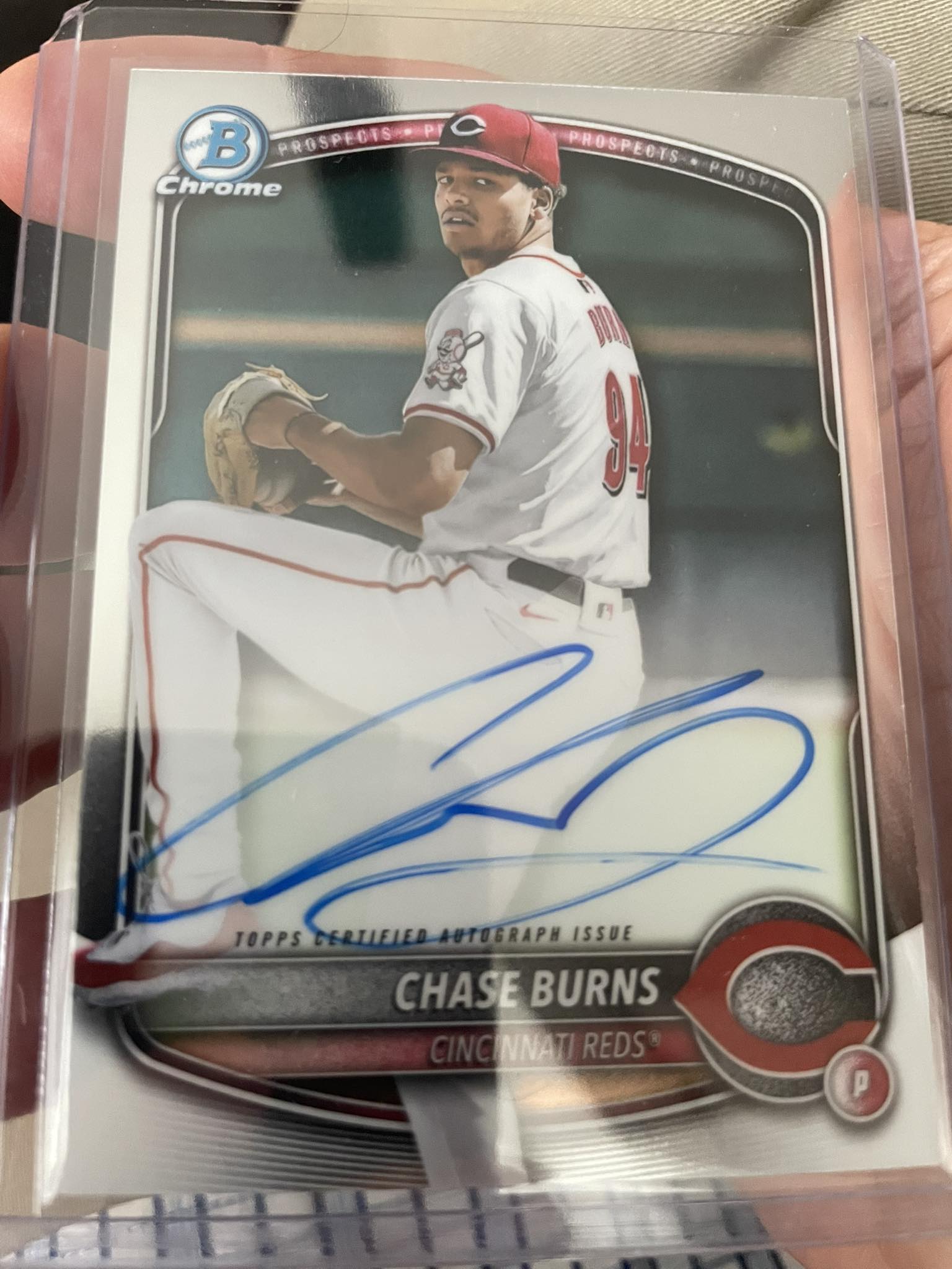 Chase Burns