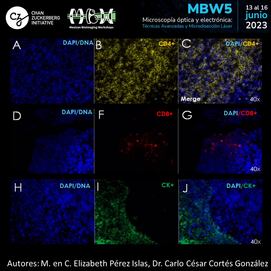 Expresión de CD4+, CD8+ y... - Mexican Bioimaging Workshops | Facebook