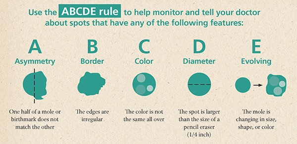WHAT IS ABNORMAL? The ABCDE... - Saint Lucia Cancer Society
