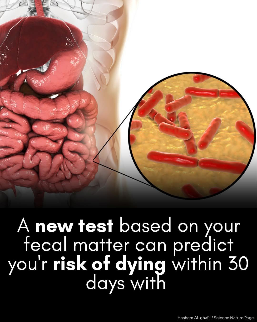 A fecal metabolic dysbiosis score (MDS) predicted 30-day mortality in critically ill patients and may help identify fecal metabolites as a potential treatable trait to improve survival in these patients. http://ms.spr.ly/6188SQmt0