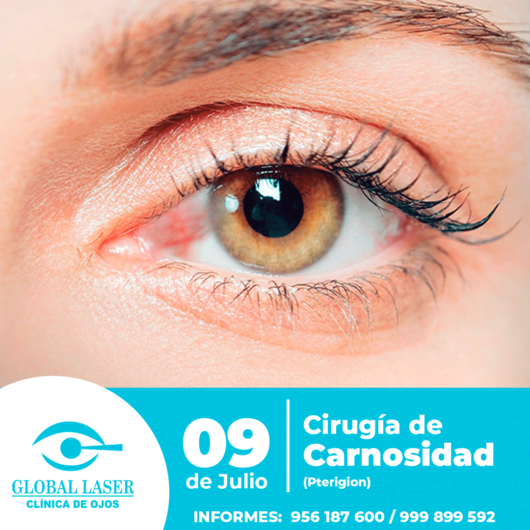 ATENCIÓN HUÁNUCO !!!... - Clínica de Ojos Global Laser | Facebook