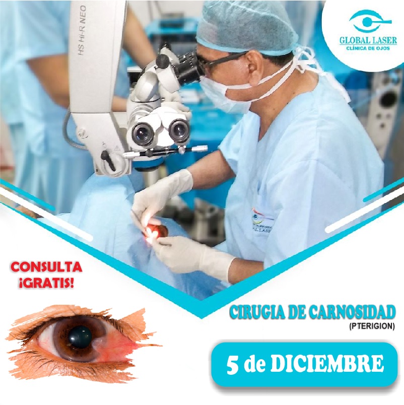 Clínica de Ojos Global Laser - Sede Barranca | Barranca