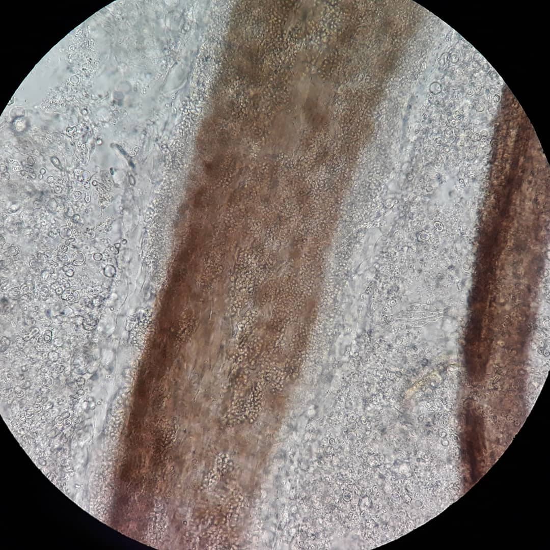 Endotrix e ectotrix 🙆🏽‍♀️ Amostra: pele... - Wil Microbiology | Facebook