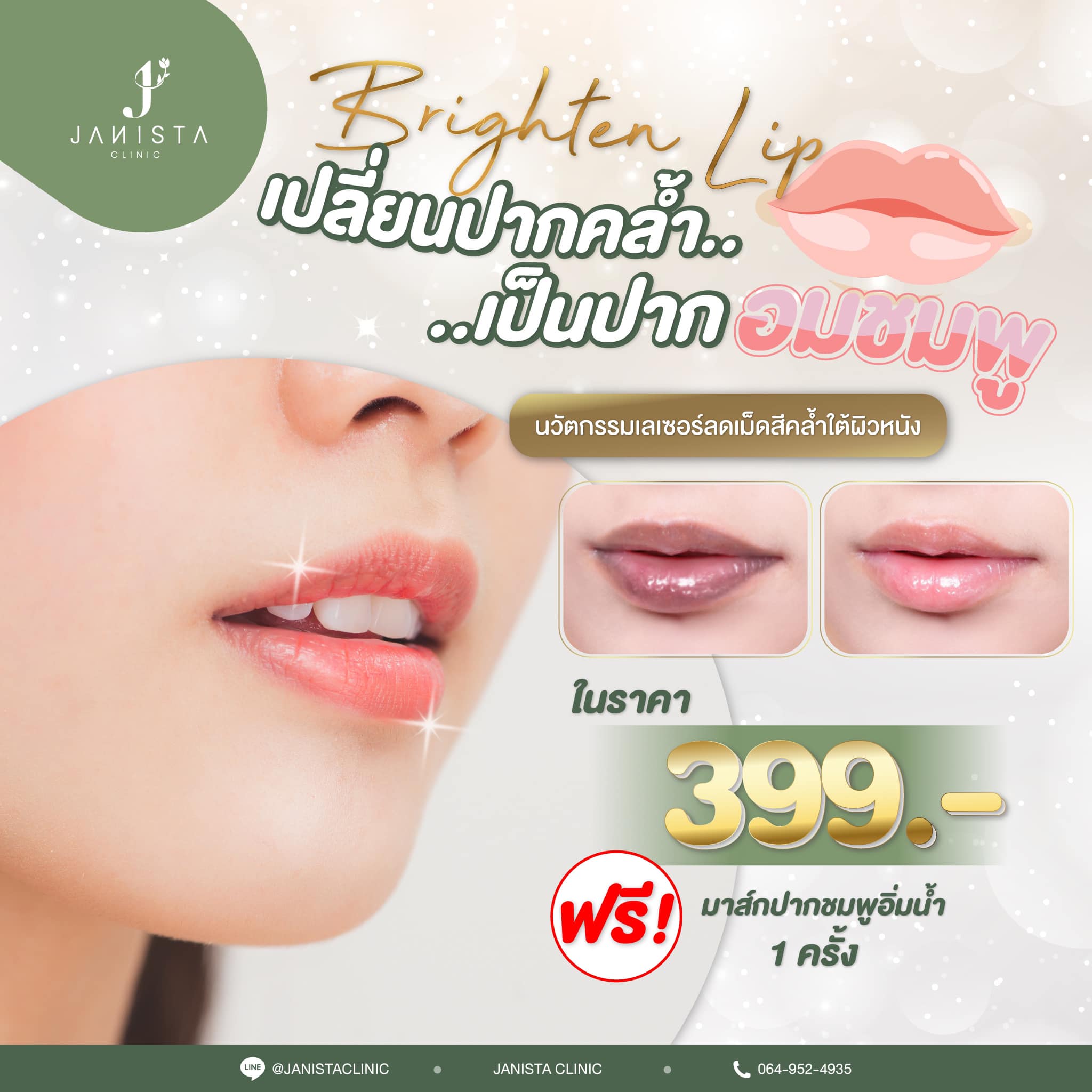 ใครมีปั... - Janista Clinic - เจนิสต้า คลินิกความงาม เชียงใหม่ | Facebook