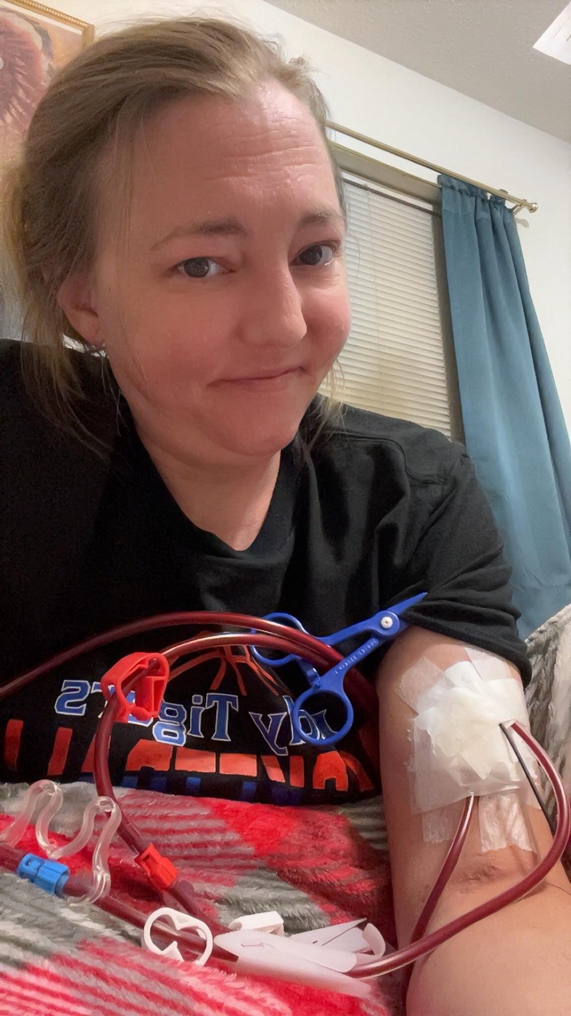 What does high arterial pressure mean during dialysis?