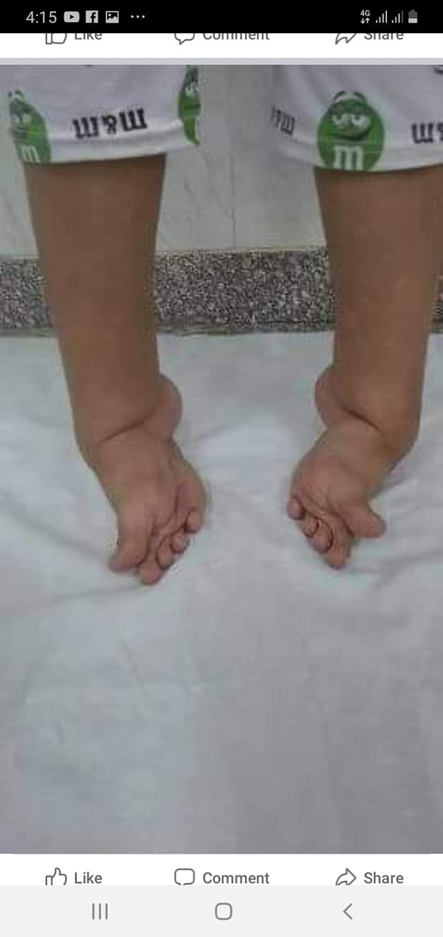 ‫عياده الدكتور محمد خالد لجراحات عظام الاطفال والقدم والكاحل Posts