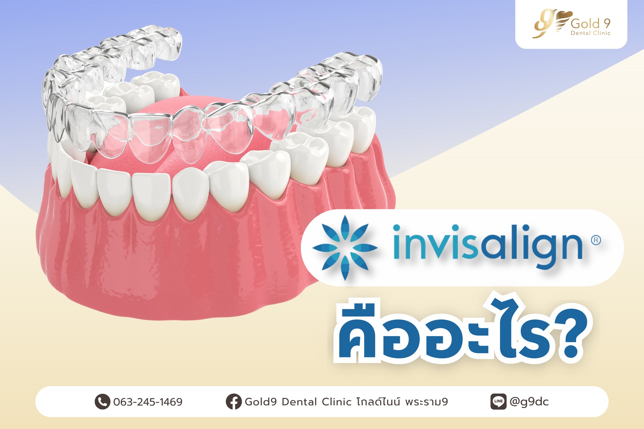 🔎Invisalign คืออะไร ทำไมการจัดฟันแบบนี้ถึงนิยมในไทยกัน เรามาทำความ ...
