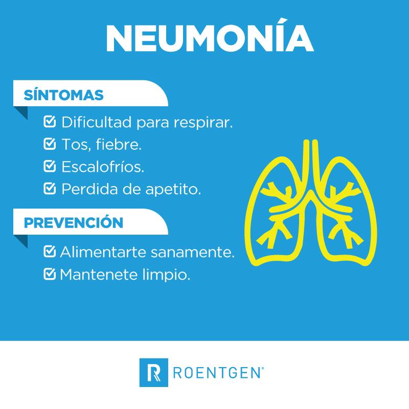 Roentgen - La #Neumonía es una infección que inflama los...