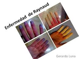 Educating Hands Argentina - Difunde: https://www.facebook.com ...