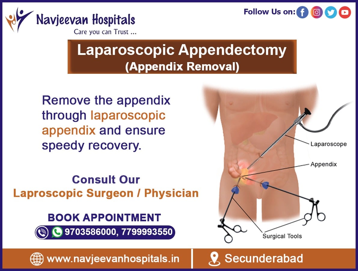 A #laparoscopic appendectomy is a... - Navjeevan Hospitals