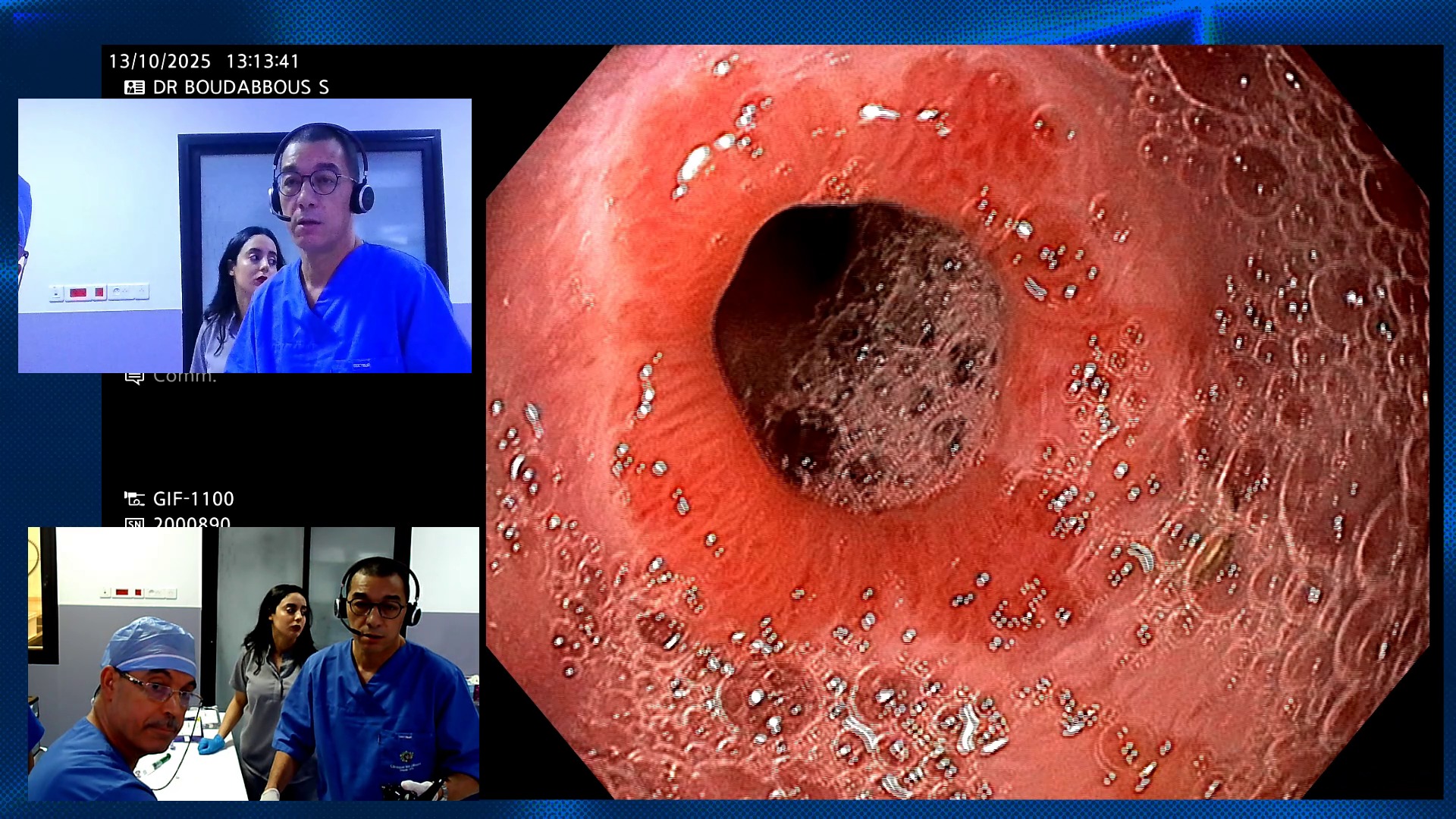 New endoscopic treatment for gastric and intestinal obstructions