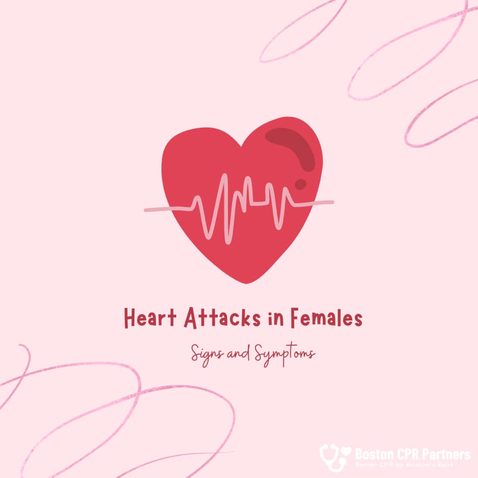 Boston - A heart attack, otherwise known as myocardial infarction (MI ...