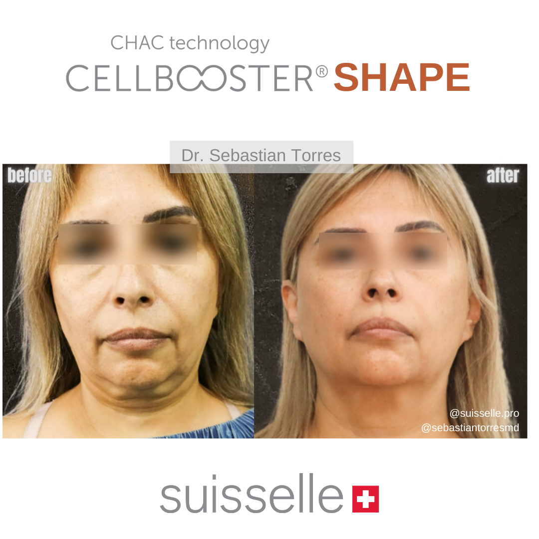 Incredible results achieved by Dr.... - Suisselle Global | Facebook