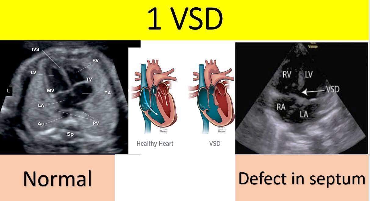 General ultrasounds…and more….🖥️ | Eight fetal cardiac anomalies that ...