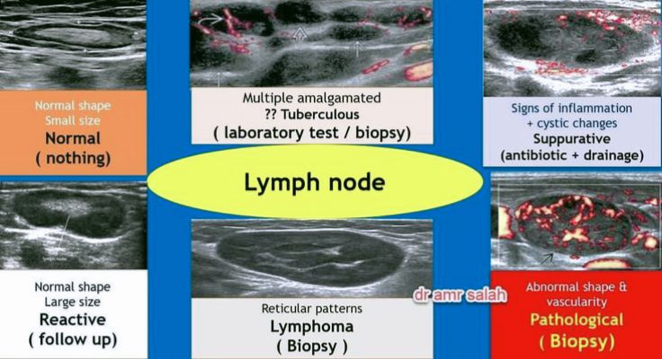 Ultrasound Knowledge Basic | This image provides an ultrasound-based ...