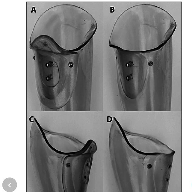 apot_tz - The MAS socket design is used by transfemoral... | Facebook