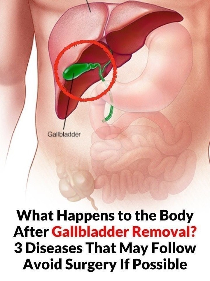 The importance of the gallbladder in digestion