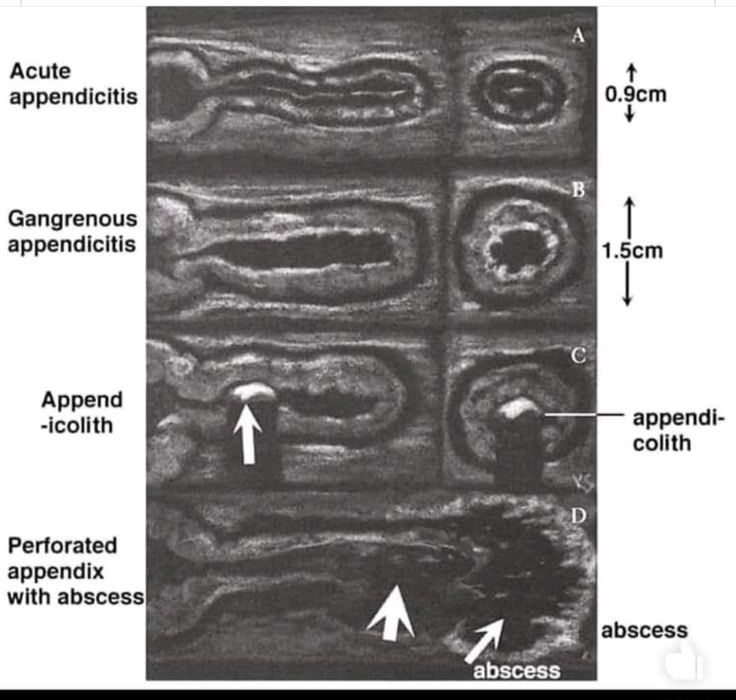 DIAGNOSTIC RADIOLOGY CLUB | This image is an ultrasound-based depiction ...