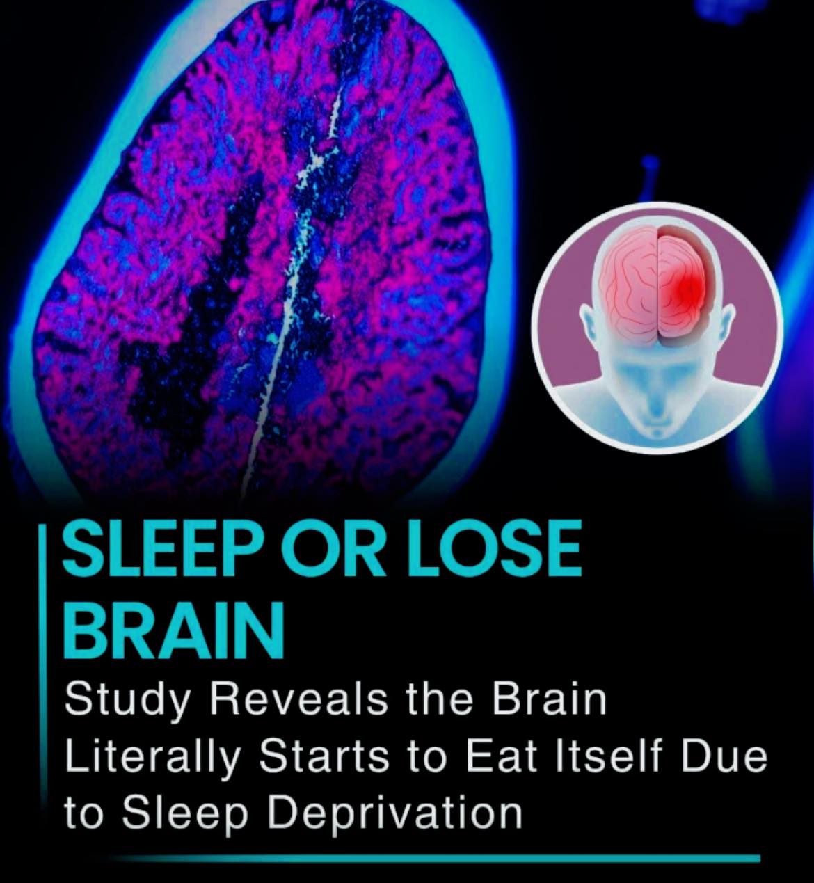 Brain scans reveal a shocking truth: chronic lack of sleep can