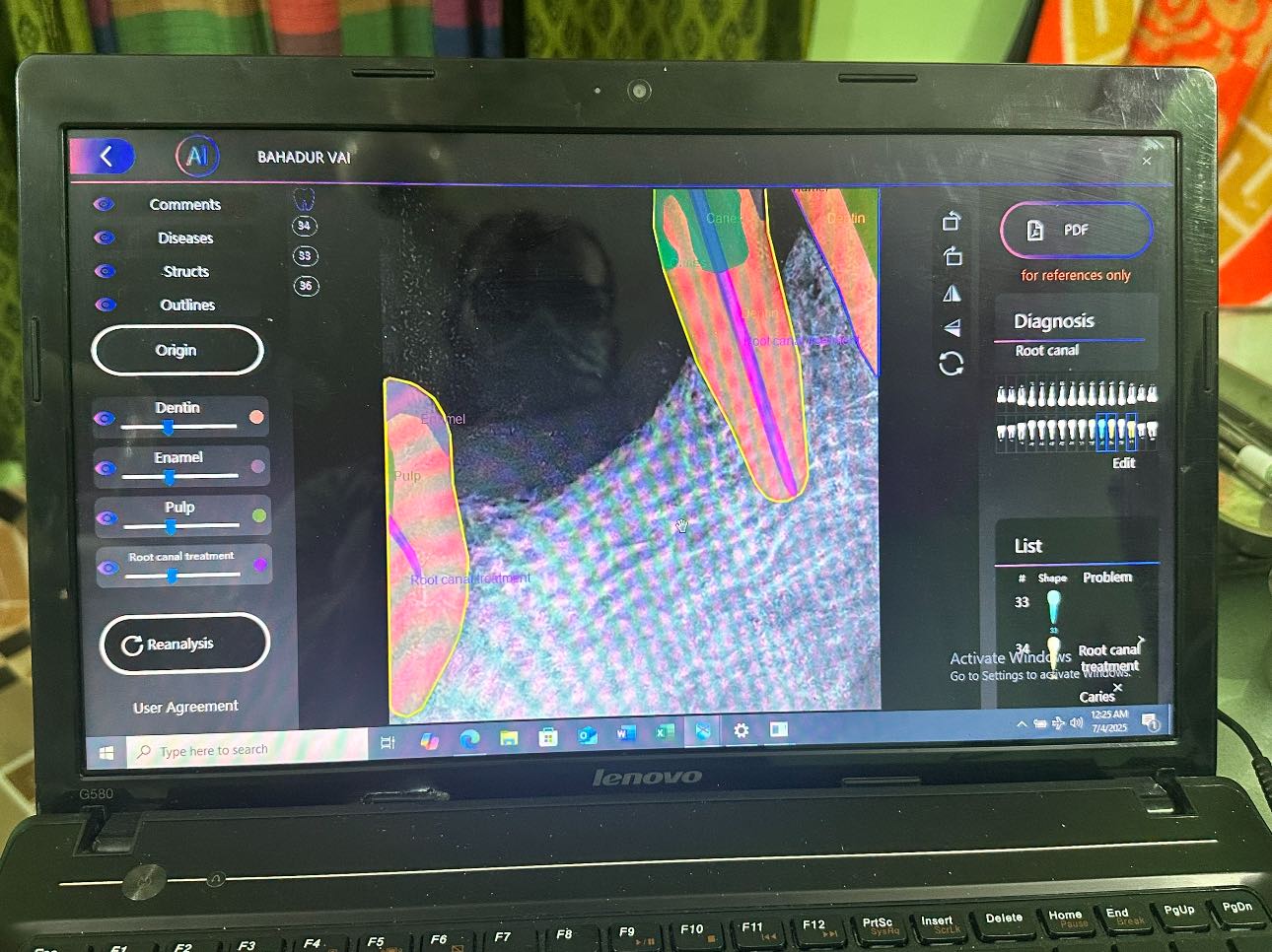 The Xpectvision Sensor AI Module... - Xpectvision Technology | Facebook