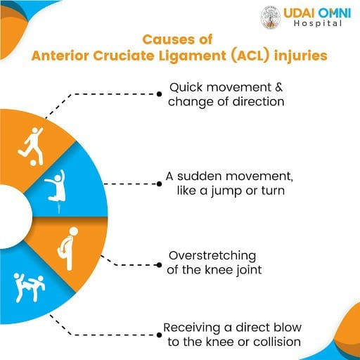 An ACL injury is a tear or sprain of... - UDAI OMNI Hospital | Facebook