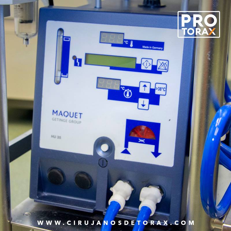 El ECMO es una... - Protorax de Colombia. Cirugía de Tórax.