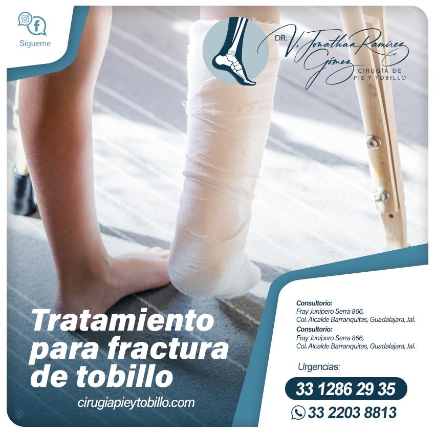 🩺Tratamiento para fractura de tobillo Un tobillo ⚠️roto o fracturado es ...