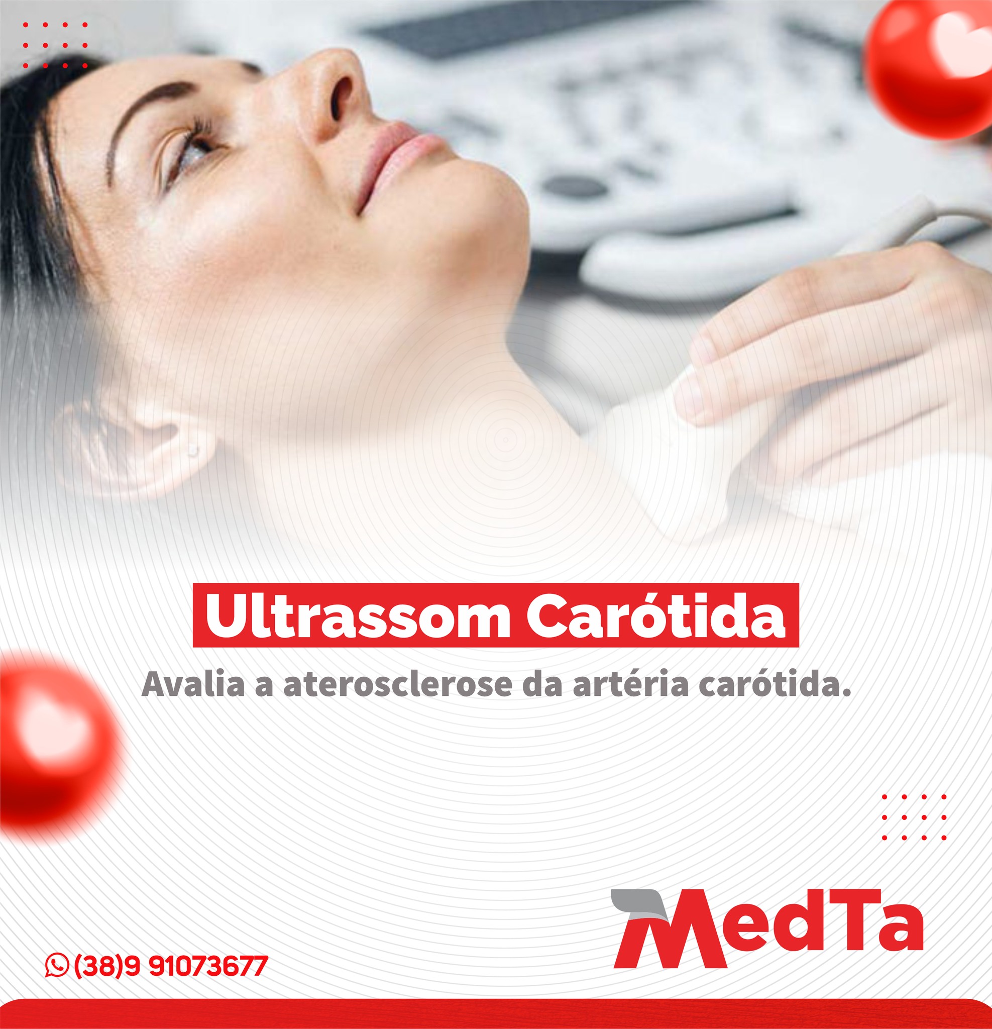 Clínica Medta - O ultrassom da carótida é um exame fácil e...