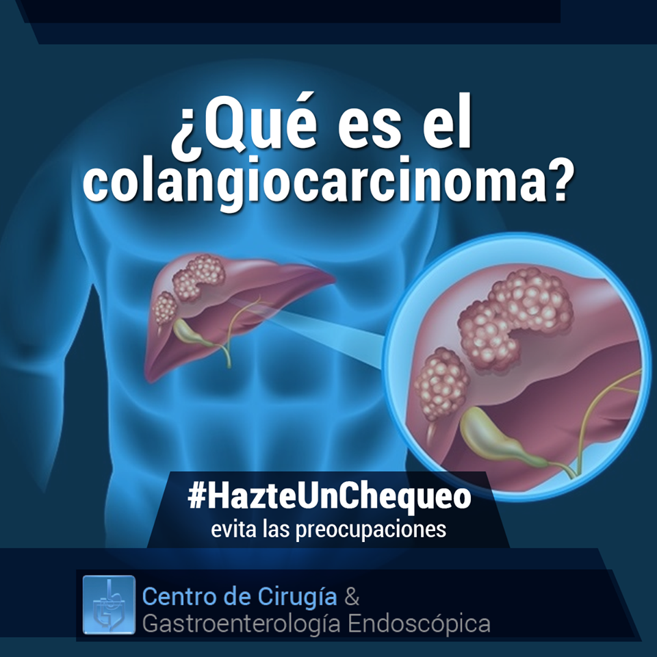 El colangiocarcinoma, o cáncer de... - Dr Juan Carlos Carames