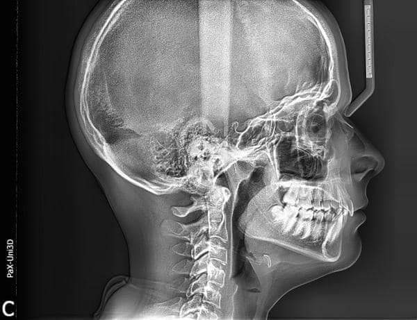 ABC Dental - 🦷 RADIOGRAFÍA DENTAL Las radiografías...