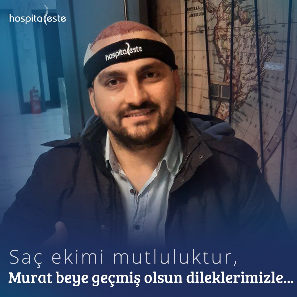 Hospitaleste - Saç ekimi mutluluktur!😎 Murat Bey'e... | Facebook