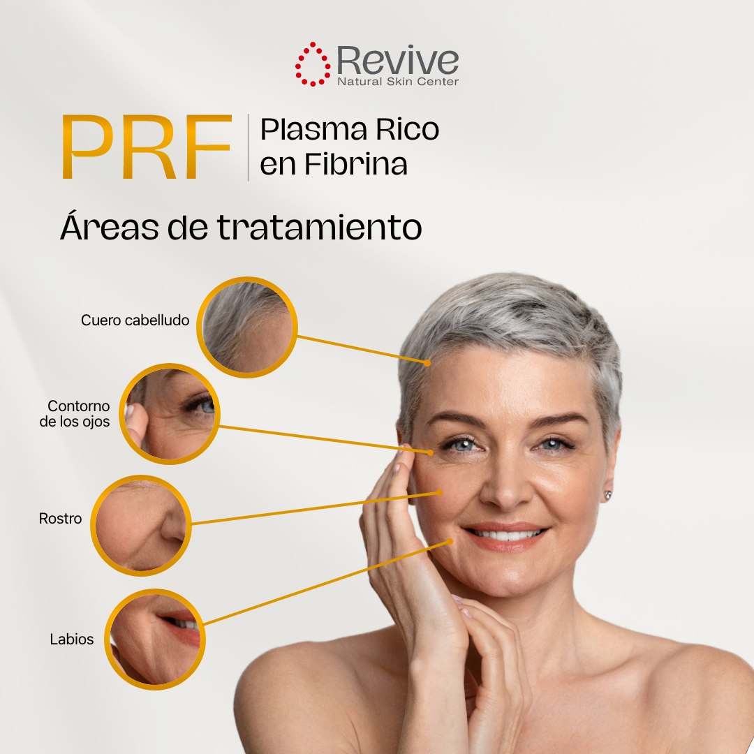 El Plasma Rico en Fibrina... - Revive Natural Skin Center