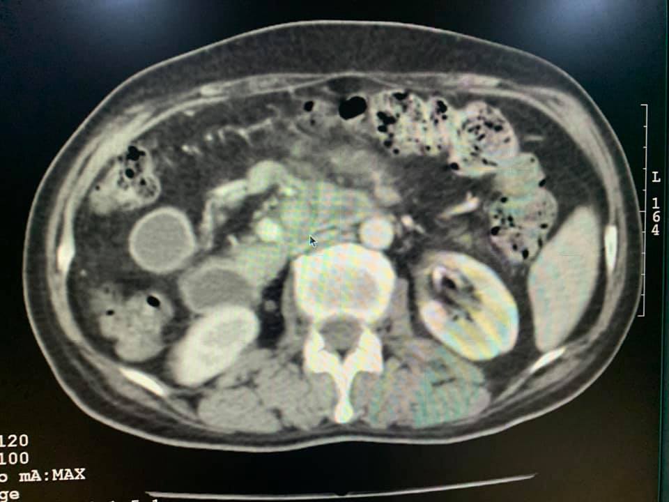 Lifeline CT Scan and Digital X - Ray