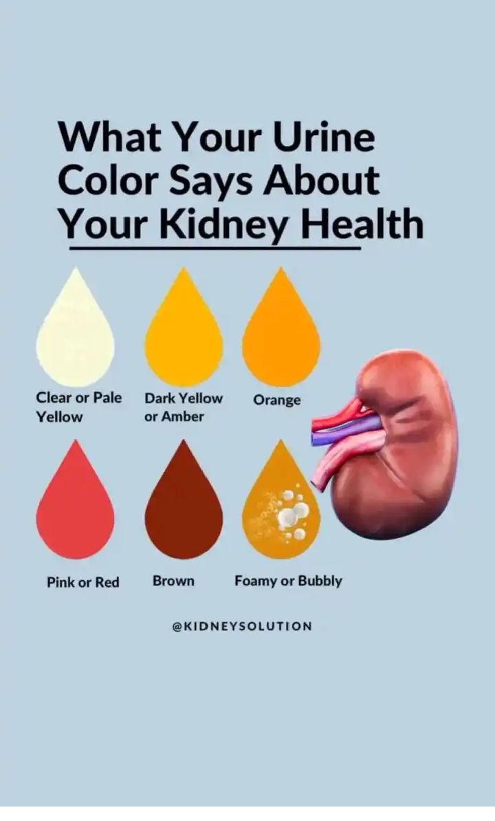 Your urine color can provide useful insights into your kidney health. Here's a breakdown of what different urine colors might indicate: 1. Clear to Light Yellow: This is generally a sign of