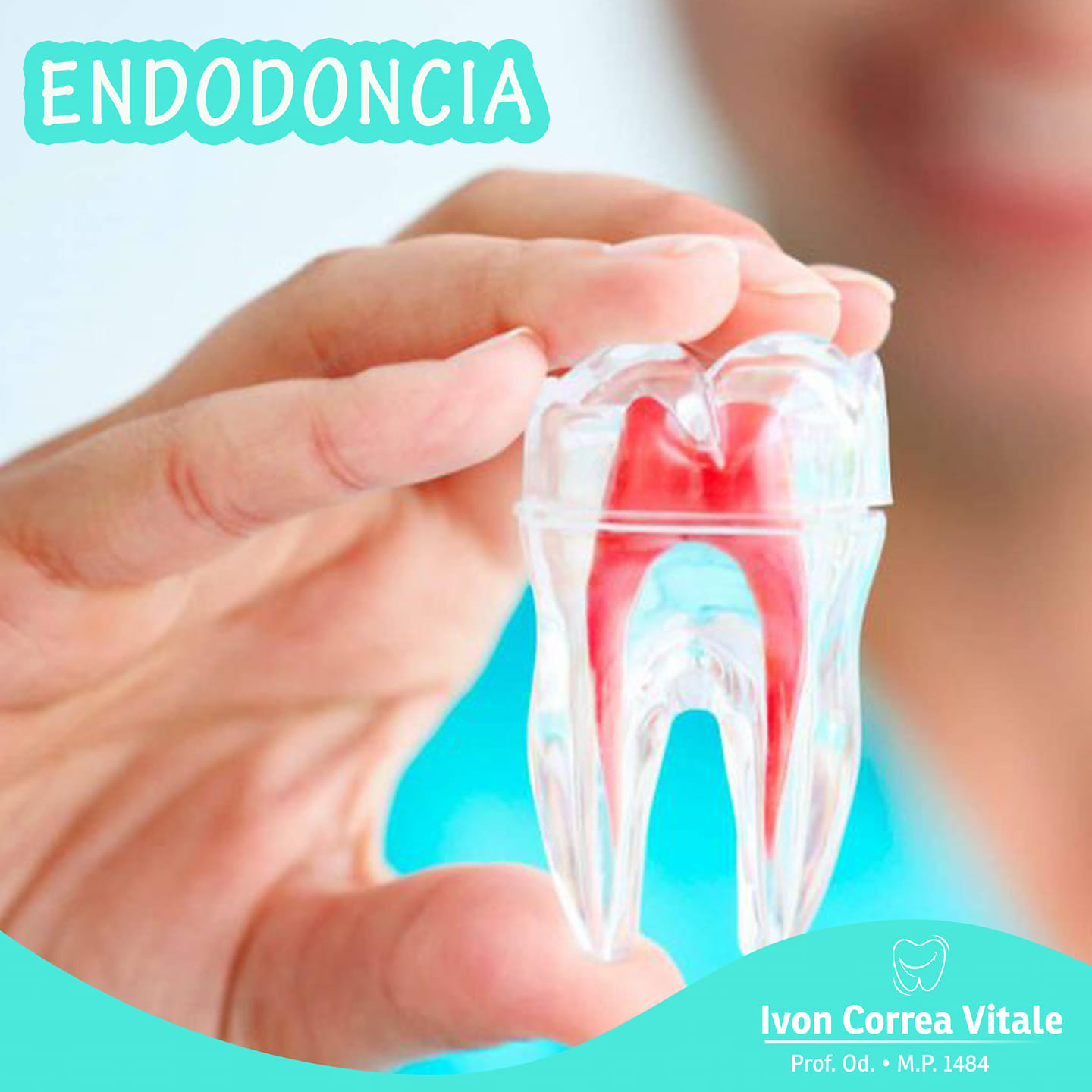 Ivon Correa Vitale - Odontóloga - ¿Cómo se realiza la endodoncia?⁣ ⁣ La ...