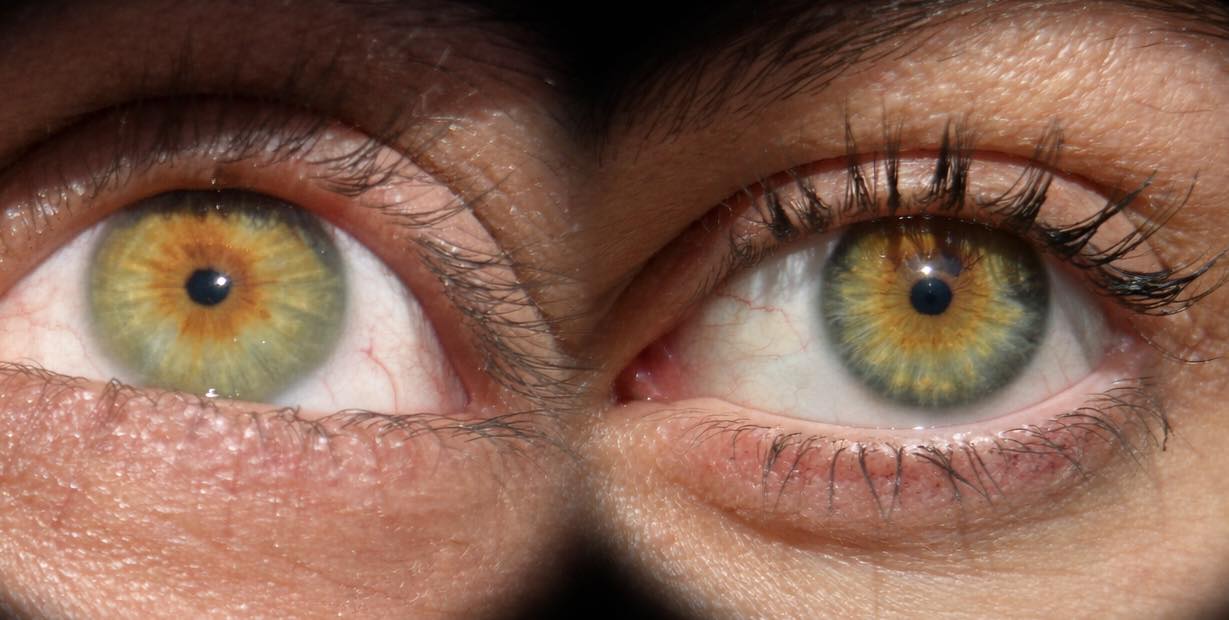 Boyfriend's eye is on the left!! Mine is on the right! What are
