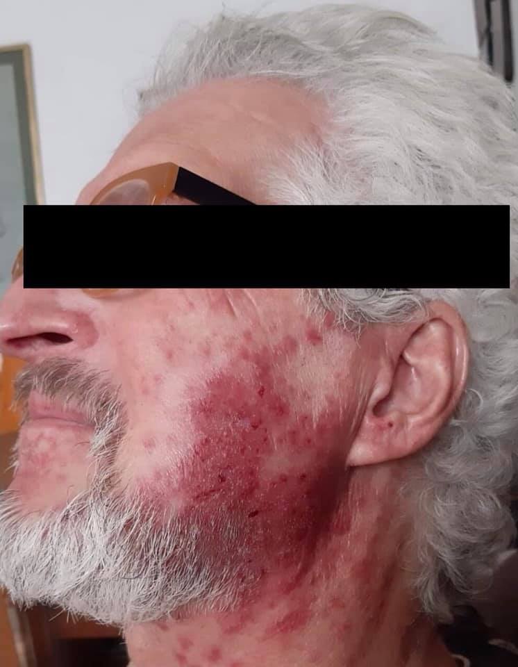 Male Pacient 60+ years old,... - Remediile Dr. Kozak