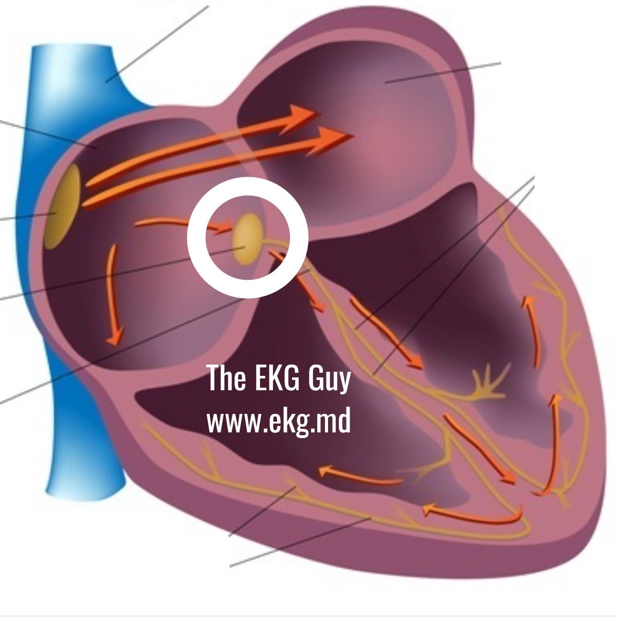 The EKG Guy - Which cardiac conduction system structure is... | Facebook