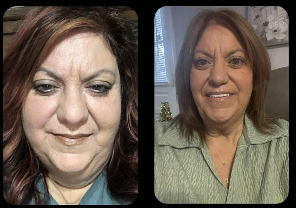 Weight Loss Transformation with Life Style Changes | Facebook