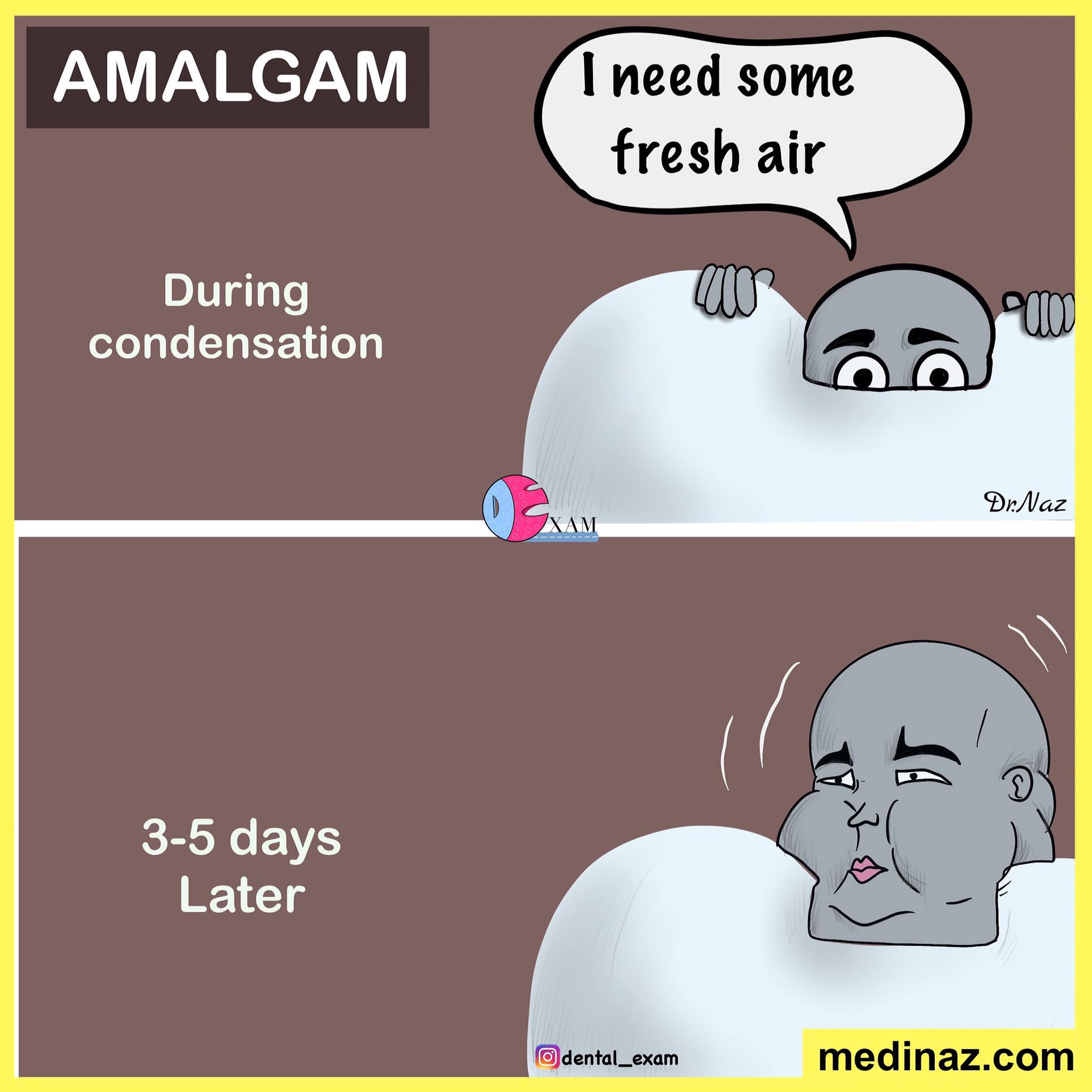Dental - Delayed expansion of Amalgam 😀 . Delayed expansion occurs when ...