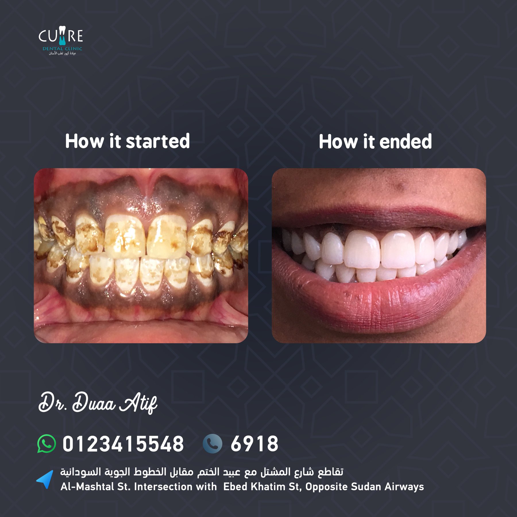 Best Implantologist In India Dental Implant Cost In India Cosmodent