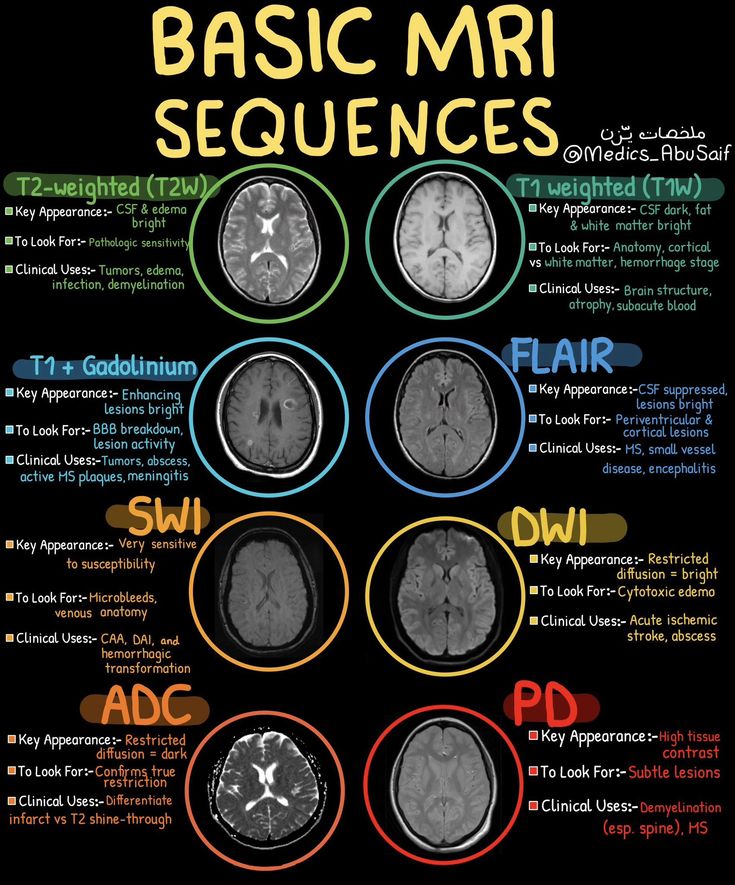 RADIOLOGY TIPS & TRICKS | Facebook