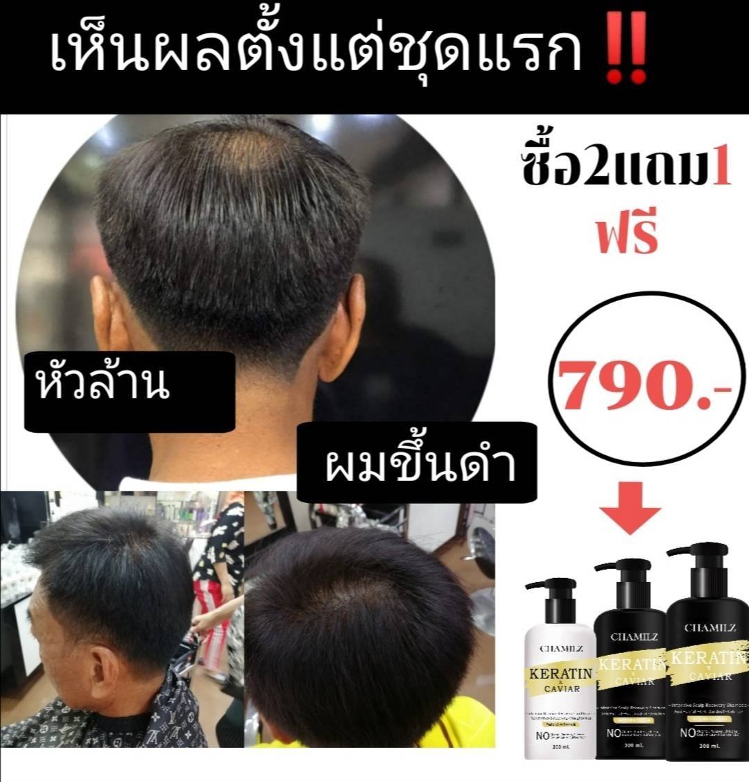 จัดโปรต่อไม่ร... - เชอร์ วอเตอร์ เจลลี่ เซรั่ม & แซมพู Chamilz | Facebook